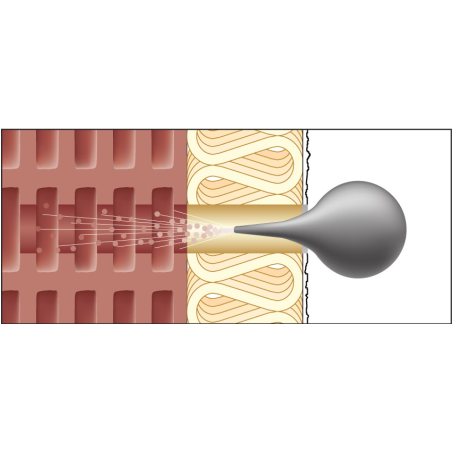 Set ResiTHERM 120 2 St., 1x ResiFIX VY300SF, Niro A4 Set
